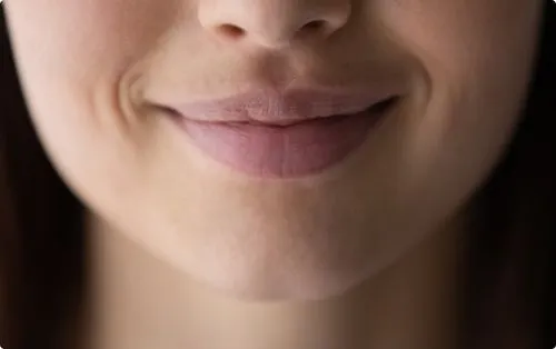 Dermal Fillers