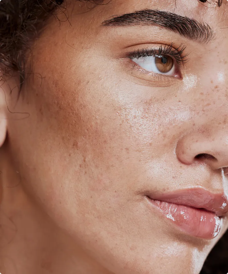 a close up of a woman with freckles on her face