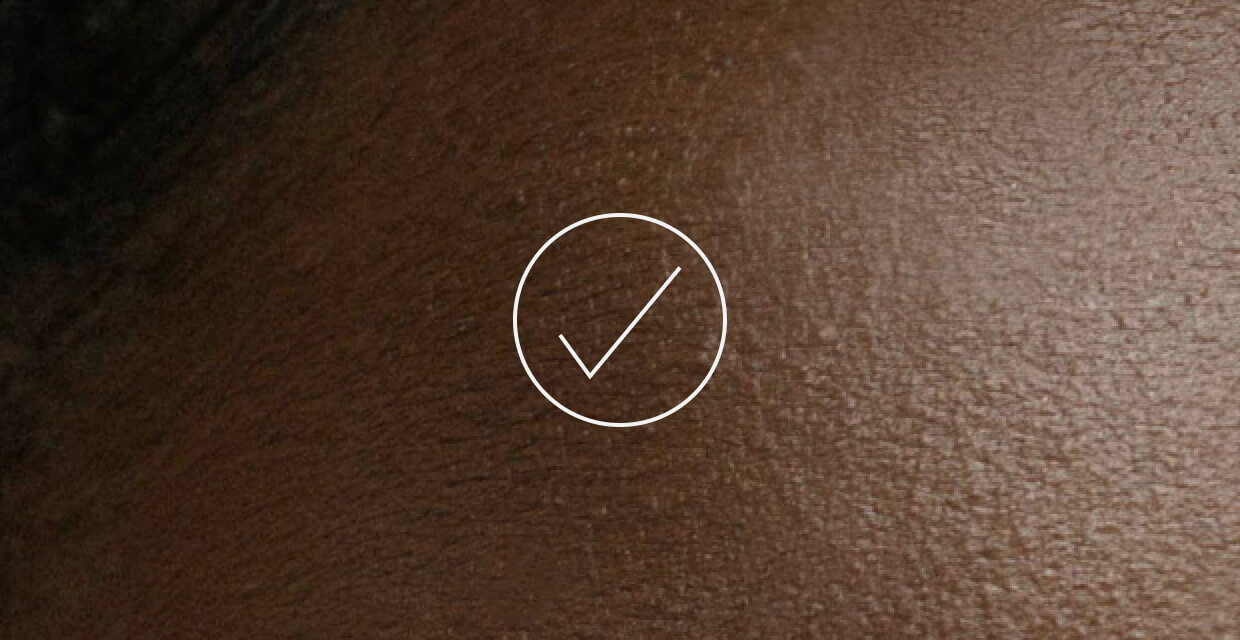 a close up of a person's skin