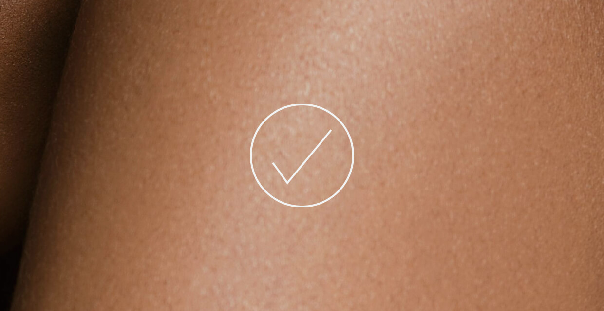 a close up of a person's skin